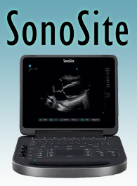 Sonosite