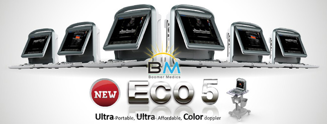 Chison Eco5 - Color Doppler